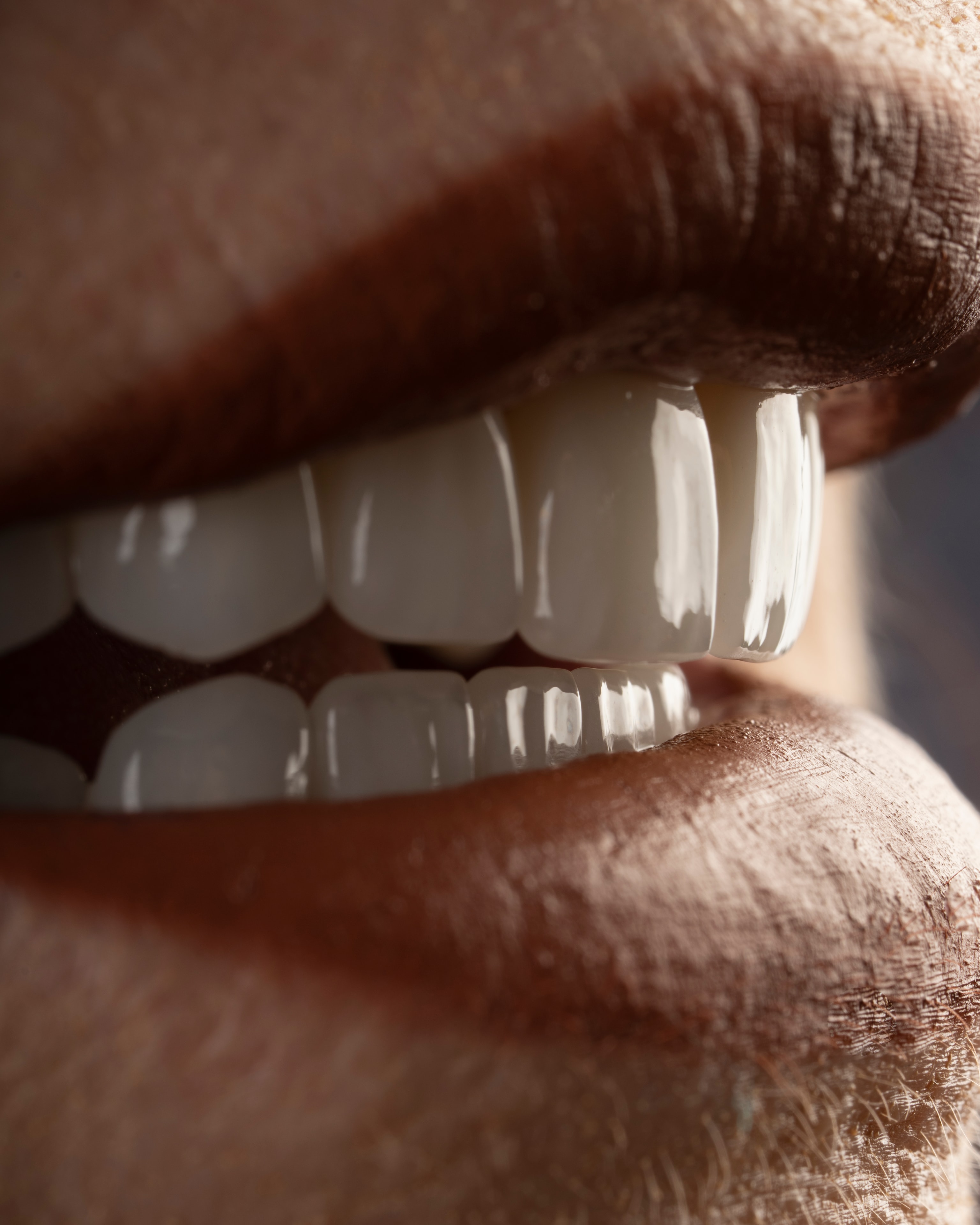 Patient smile transformation