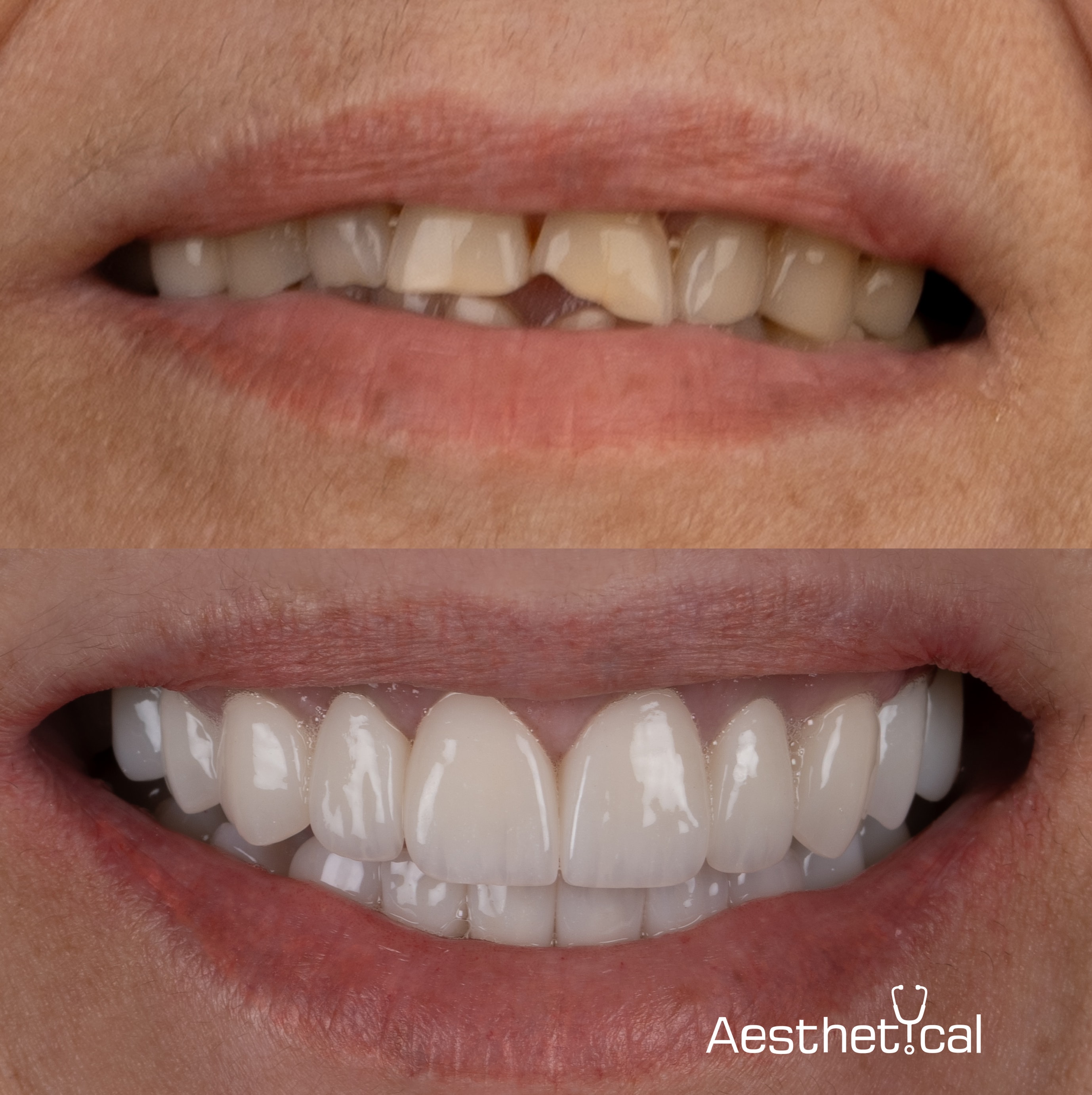 Patient smile transformation